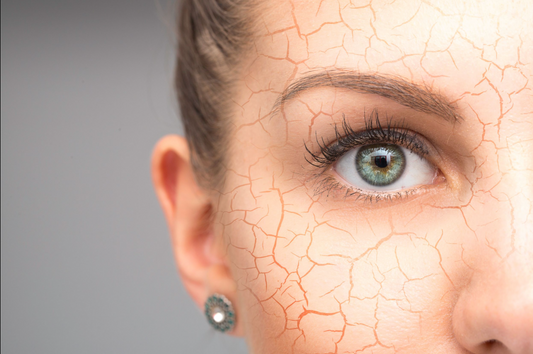 Perimenopause Is Changing Your Skin.